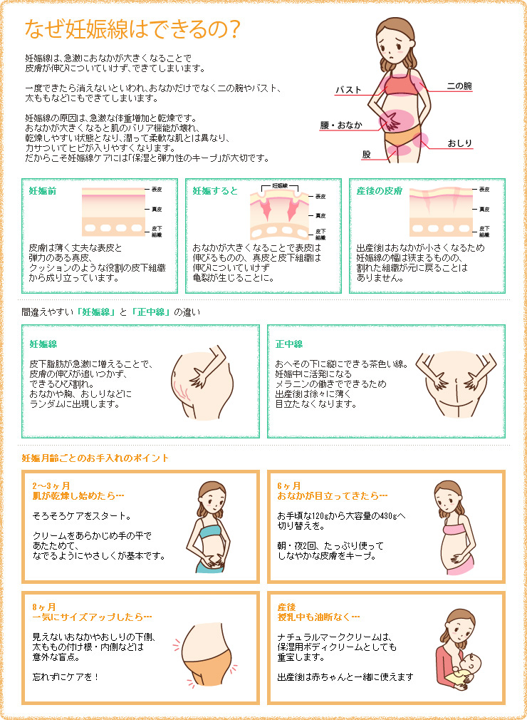 日本评价最高的妊娠纹专用护理乳液——MAMA&KIDS